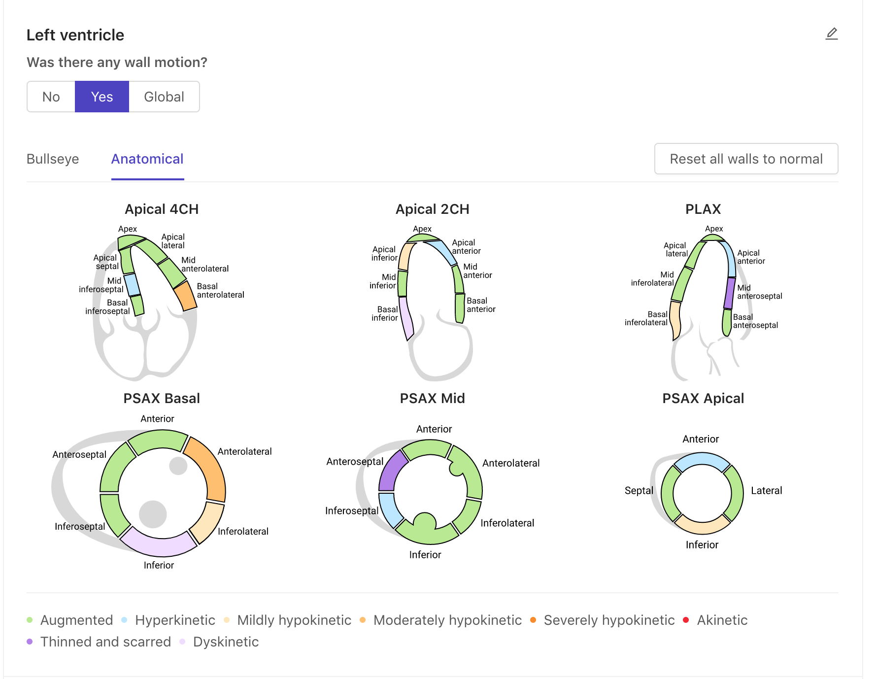 Anatomical wall motion diagrams
